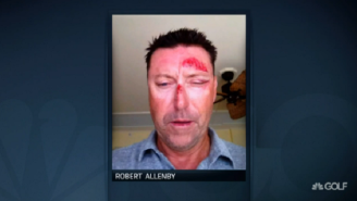 Golfer Robert Allenby Allegedly Drugged, Kidnapped, Beaten, And Robbed In Hawaii