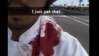 This Mesa Shooting Victim Shared A Picture Of His Gunshot Wound On Snapchat