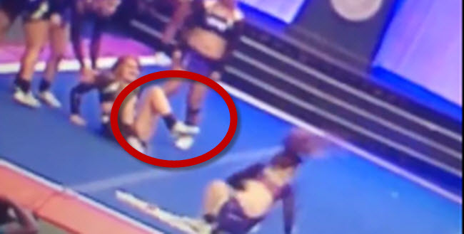This Cheerleader Suffered One Of The Most Horrific Leg Injuries Youll