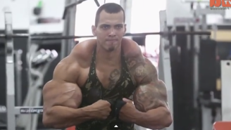 This Bodybuilder Almost Lost His Arms After Trying To Look Like The Hulk