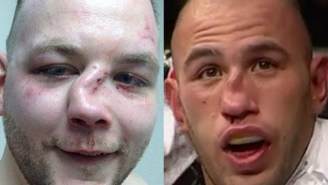 Watch A Compilation Of The Worst Broken Noses In MMA History
