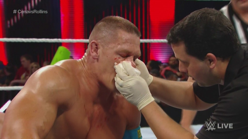 John Cena And Nine Other Gruesome Wwe Broken Noses