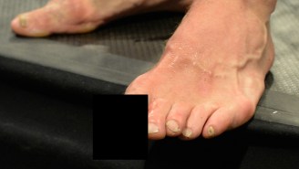 Here’s The Disgusting Toe Injury Michael Bisping Suffered During UFC Fight Night 72