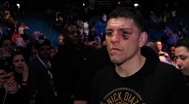 nick-diaz-GettyImages-462600490-small