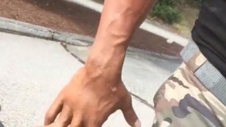 The Rock Dislocated His Finger And It’s Absolutely Disgusting