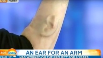 This Australian Man Has A Legit Third Ear Growing Out Of His Arm
