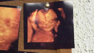 This Ultrasound Reveals These Parents Are Getting A Demon Instead Of A Baby