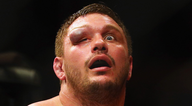 matt-mitrione-eye-egg