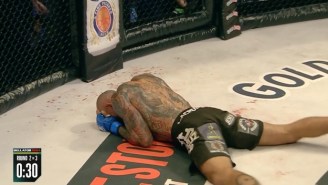 These Photos Of Cyborg Santos’ Skull Fracture Are Brutal