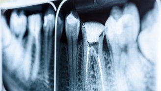 Thanks To Technology And Stem Cells, Root Canals May Soon Become A Thing Of The Past