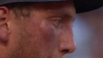 Hunter Pence Fouled A Ball Off His Face So Hard You Can See The Seam Imprints
