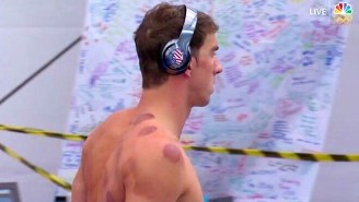 Why Is Michael Phelps Covered In Circular Bruises? What You Need To Know About Cupping