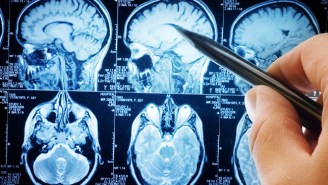 An Experimental New Drug May Soon Make Alzheimer’s A Treatable Condition