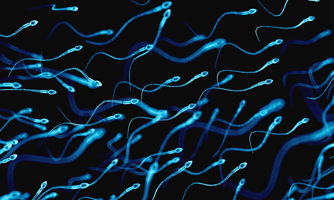 sperm