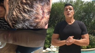 Alberto El Patron Suffered Multiple Injuries After Being Assaulted With A Knife