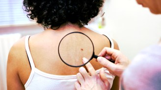 A New Algorithm Has Beaten 21 Doctors At Spotting Skin Cancer