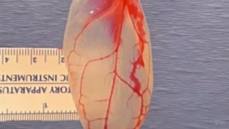 Spinach Turned Into Heart Tissue May End The Organ Transplant Crisis