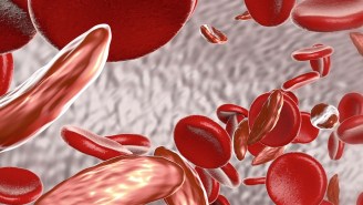 Finish Sickle Cell Awareness Month By Learning More About The Disease