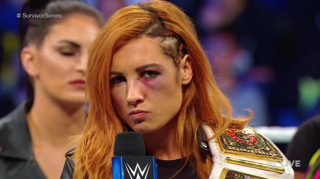 Becky Lynch Explains Why She Doesn't Handle Her Own Twitter