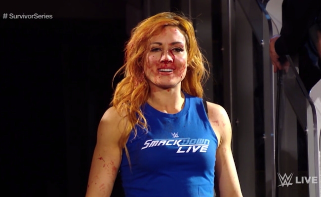 becky lynch bloody face shirt