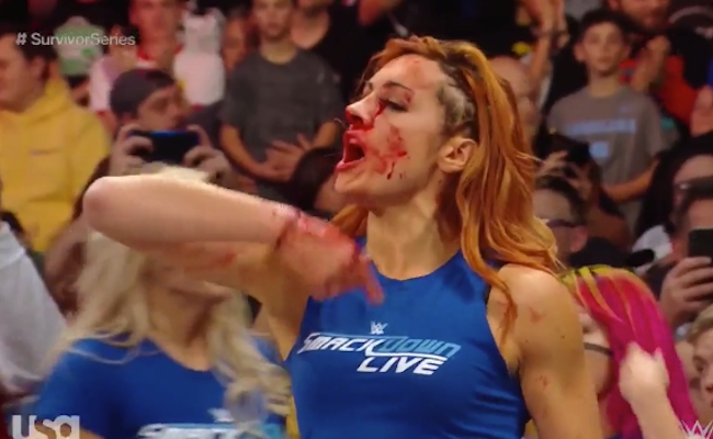 becky lynch bleeding shirt