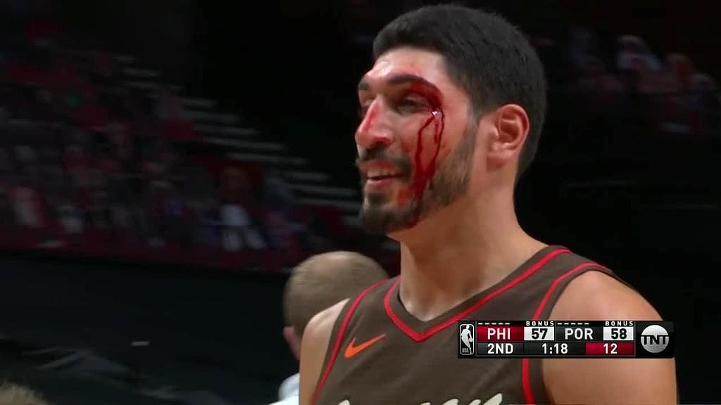 Enes Kanter Got A Nasty Cut By His Eye After Taking A Teammate S Elbow