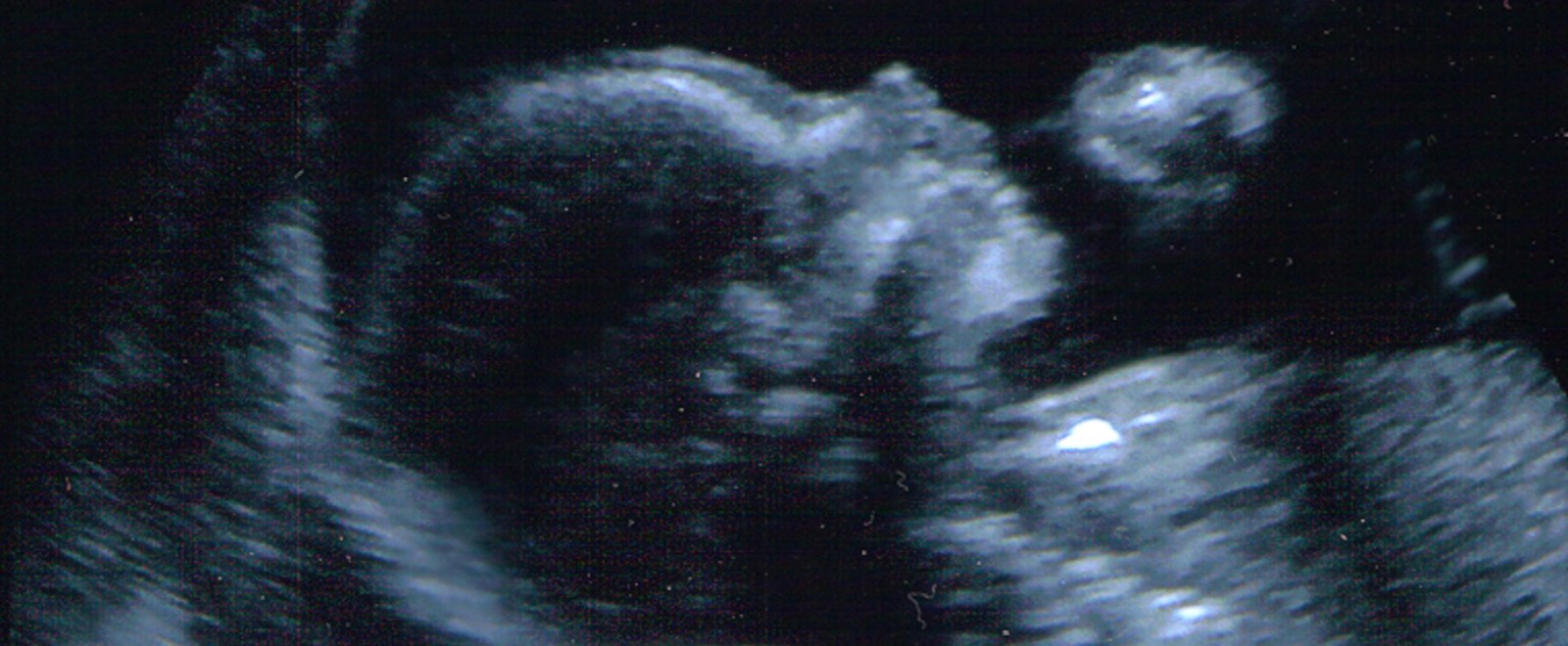 ultrasound-baby-the_luna-flickr-full.png