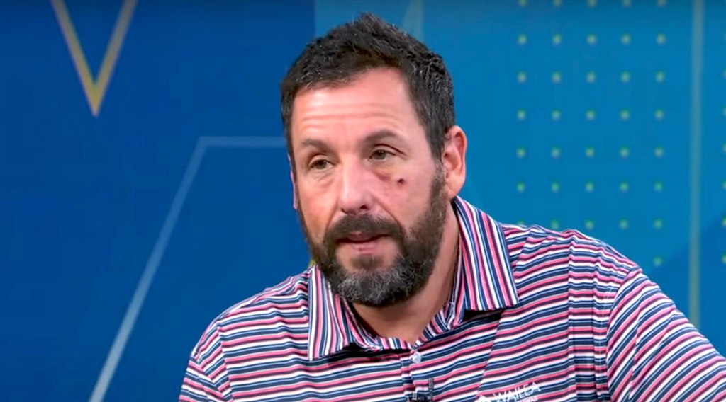 Adam Sandler Reveals 'Bed Accident' That Caused Black Eye(02)