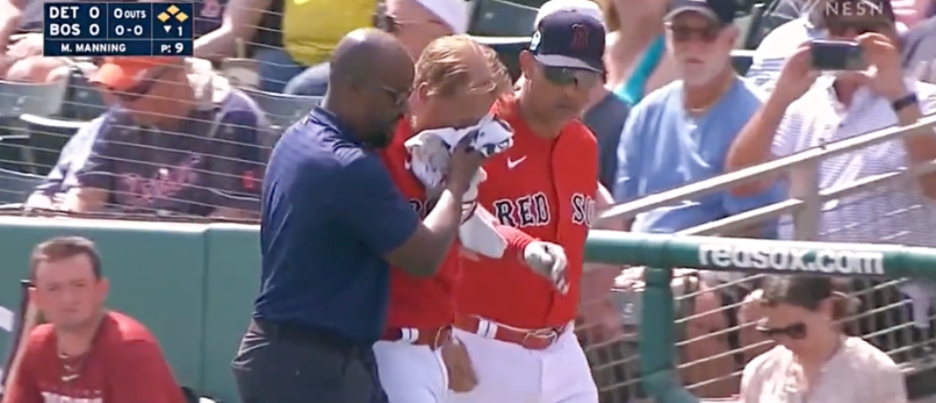 Justin Turner INJURED AFTER HIT-BY-PITCH TO FACE!, Boston Red Sox
