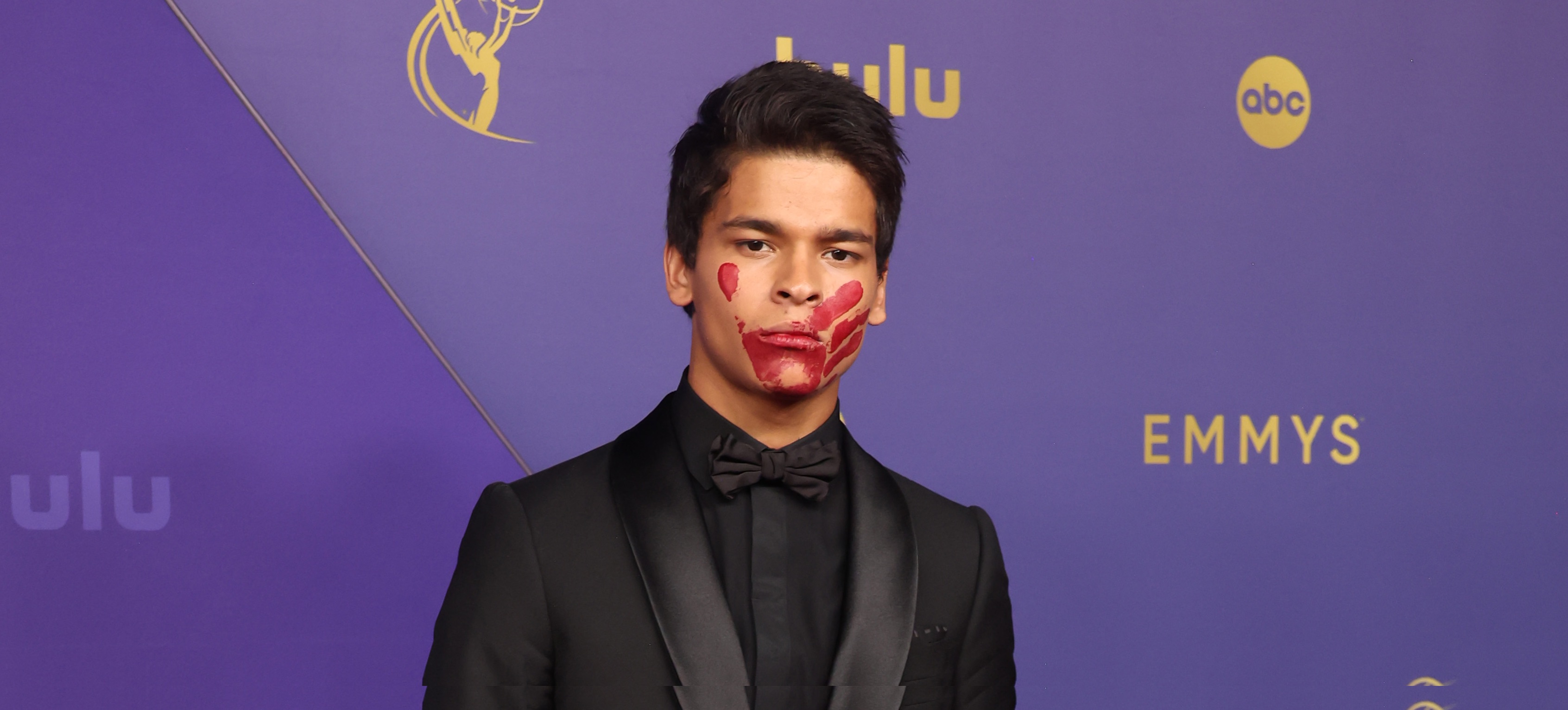 Why Did 'Rez Dogs' Star Wear A Red Hand Symbol At The Emmys?